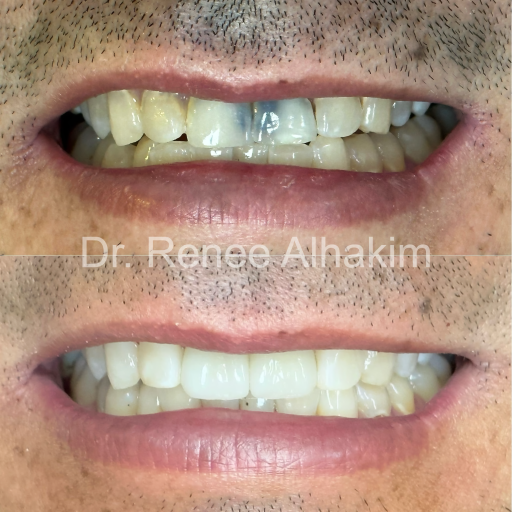 Imperfect smile close-up