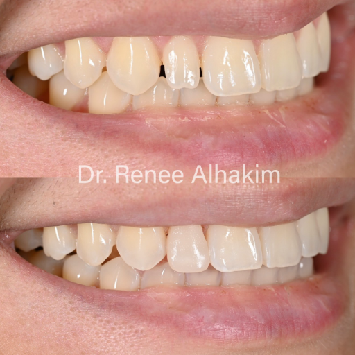 Smile transformation comparison