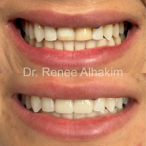 Perfect smile close-up