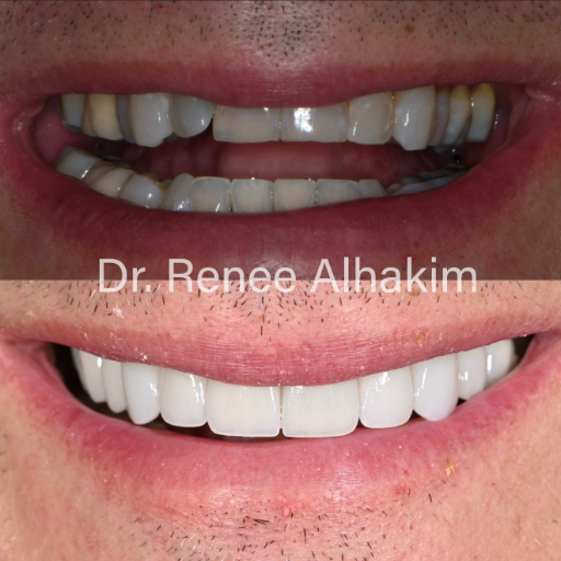 Dental transformation