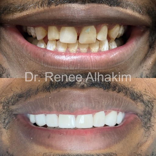 Perfect smile close-up