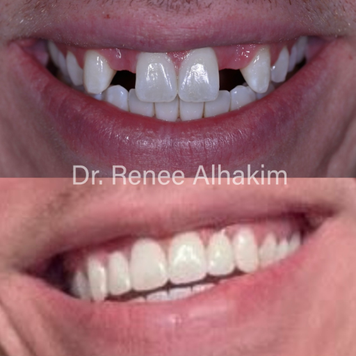 Dental transformation