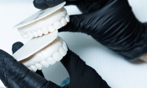 Full mouth reconstruction dental treatment to restore worn down teeth