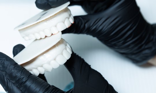 Full mouth reconstruction dental treatment to restore worn down teeth