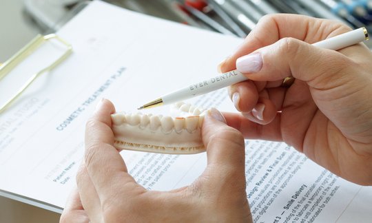 Cosmetic dentistry comparison between veneers and dental bonding